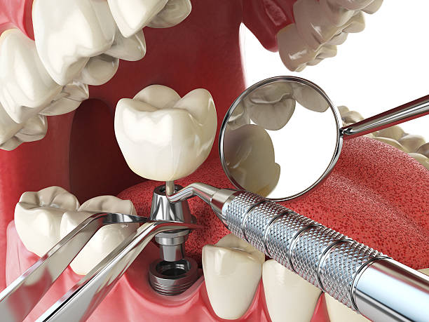 Best Emergency Care for Gum Disease in Roessleville, NY